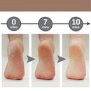 Soft Feet - Removedor de Calos Rachaduras dos Pés - Realeza Prime